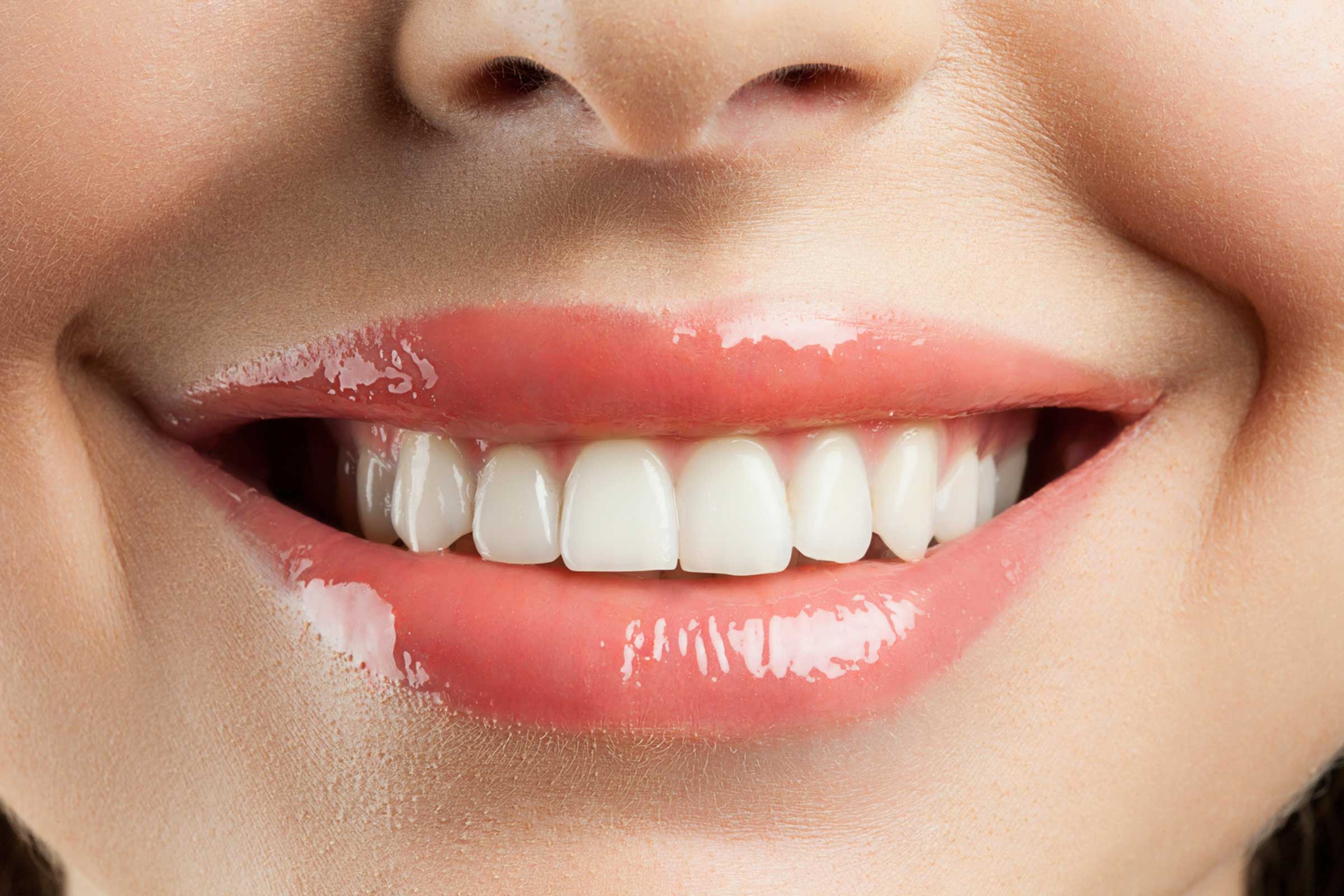 Форма зубов клыки. Красивые зубы. Красивые ровные зубы. Красивая форма зубов. Красивая улыбка зубы.